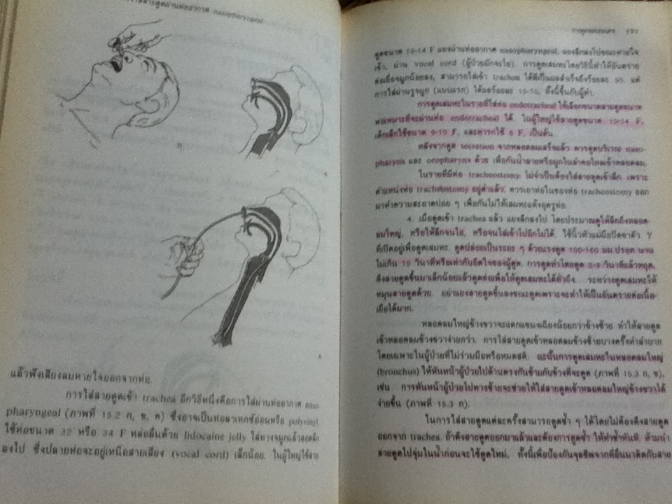 การปฏิบัติการและหัตถการทางอายุรศาสตร์/ สง่า นิลวรางกูร และ จินตนา ศิรินาวิน: บรรณาธิการ
