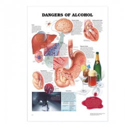แผ่นภาพนูน 3D อันตรายของสุรา (อังกฤษ)